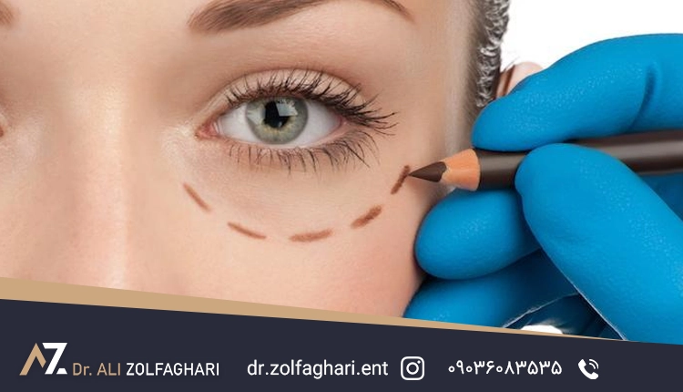 دوران نقاهت جراحی زیبایی چشم