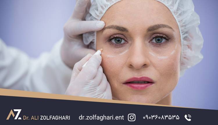جراح زیبایی چشم