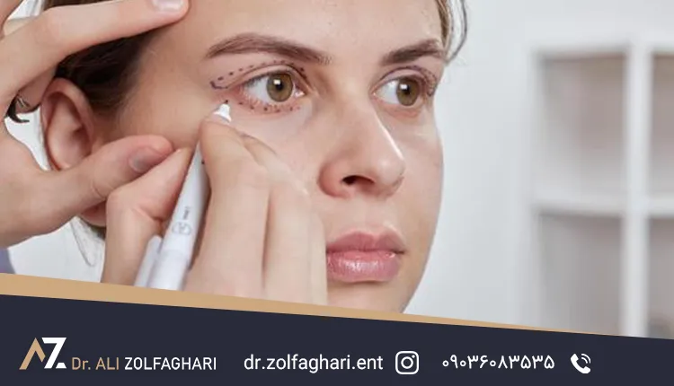 هزینه های جراحی زیبایی چشم و شرایط