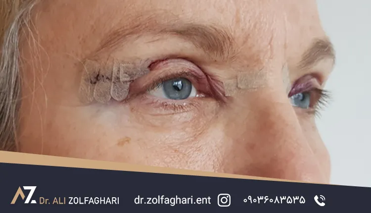 قیمت عمل زیبایی 