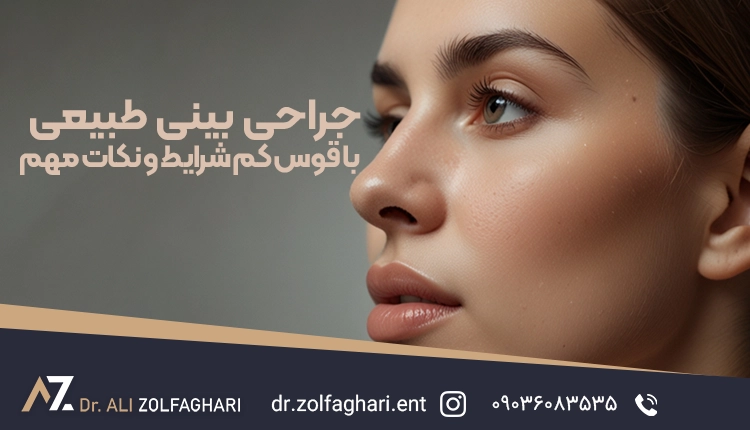 جراحی بینی طبیعی با قوس کم شرایط و نکات مهم