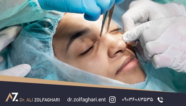 هزینه جراحی پلک بالا | هزینه بلفاروپلاستی در سال 1404
