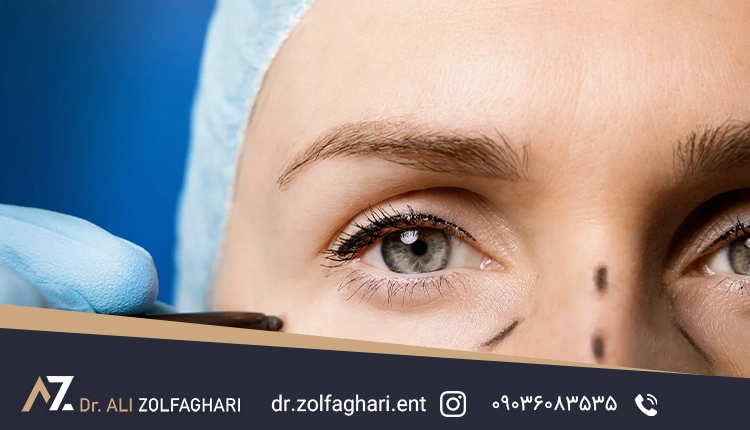 نکات مهم قبل و بعد از لیفت صورت