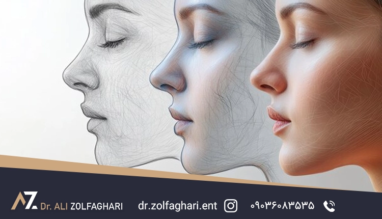 هزینه عمل بینی استخوانی بیشتر است یا هزینه عمل بینی گوشتی؟
