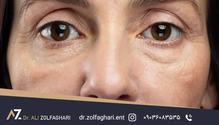 قیمت عمل زیر چشم در کلینیک‌های مختلف 