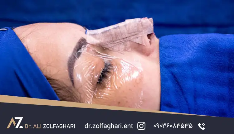 کاندیدای مناسب برای عمل بینی بدون تامپون