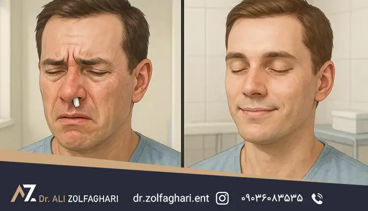 جراحی بینی بدون تامپون چیست؟