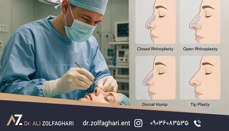 انواع عمل رینوپلاستی چیست ؟