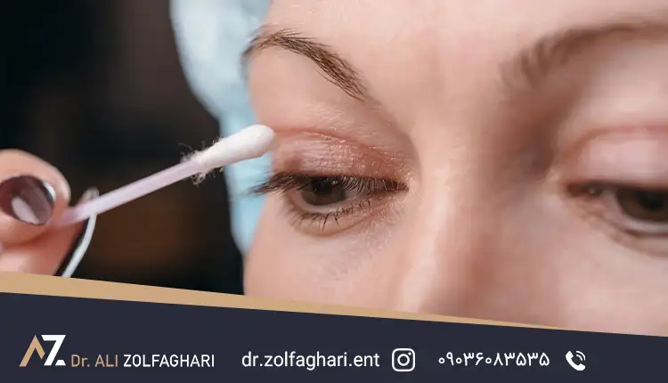 ماندگاری عمل بلفاروپلاستی