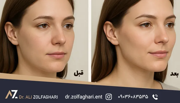 علت انجام پروتز گونه