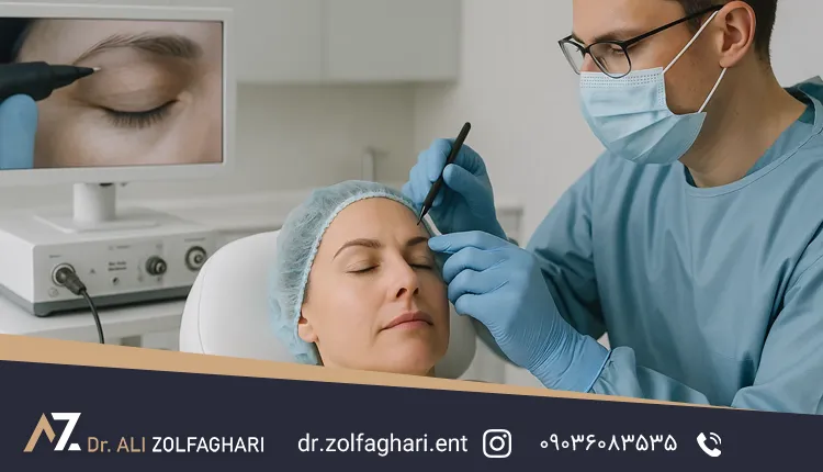لیفت ابرو آندوسکوپی