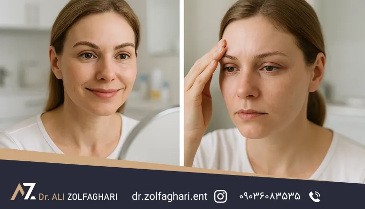 مزایا و معایب لیفت ابرو