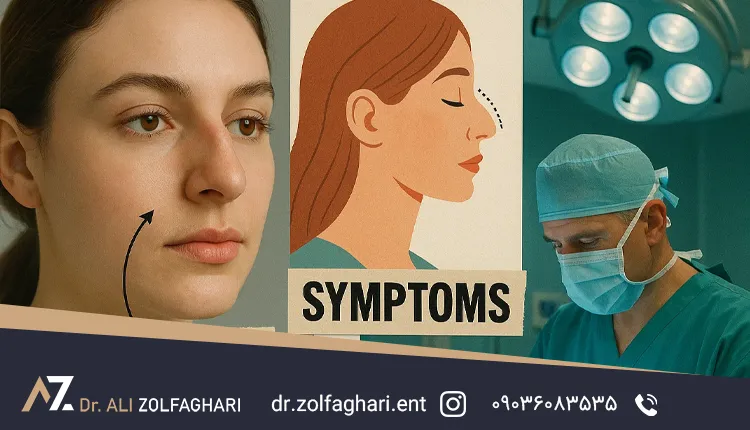 علائم قوز بینی