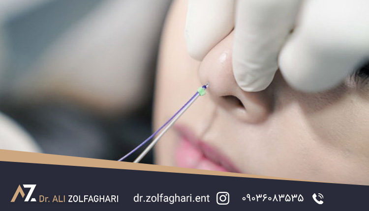 رینوپلاستی بدون جراحی