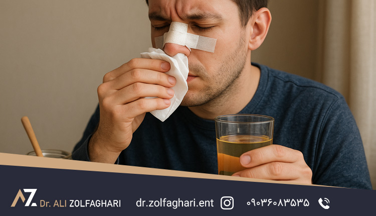 آبریزش بینی بعد از رینوپلاستی
