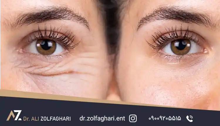 جراحی ترمیمی