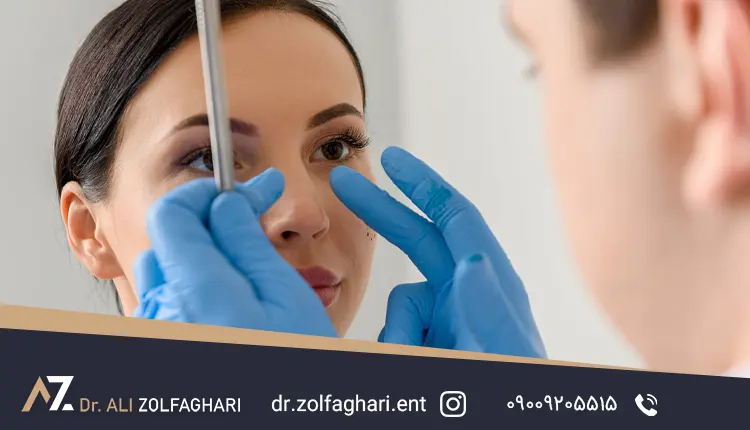 انواع گرافت بینی