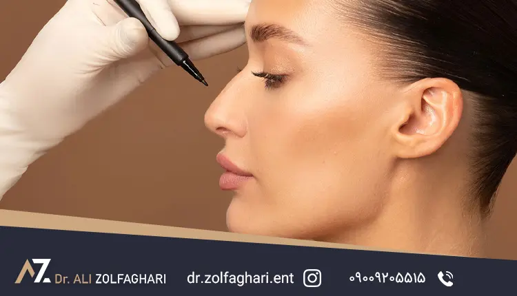 رینوپلاستی طبیعی و ترند قوز بینی ۲۰۲6