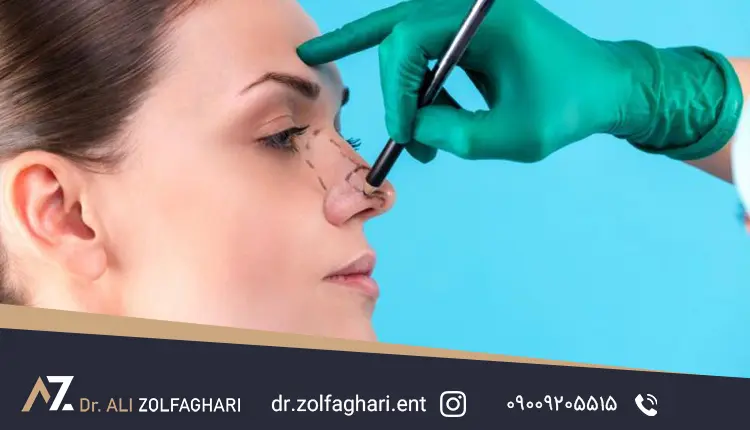گرافت بینی چیست