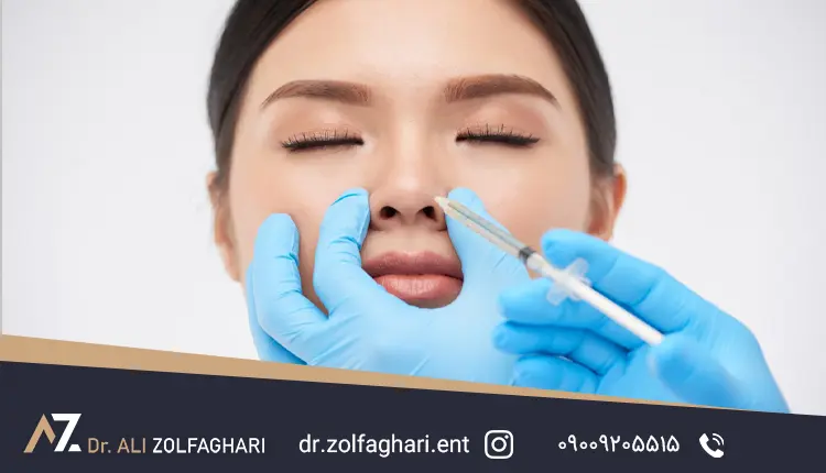 گرافت بینی