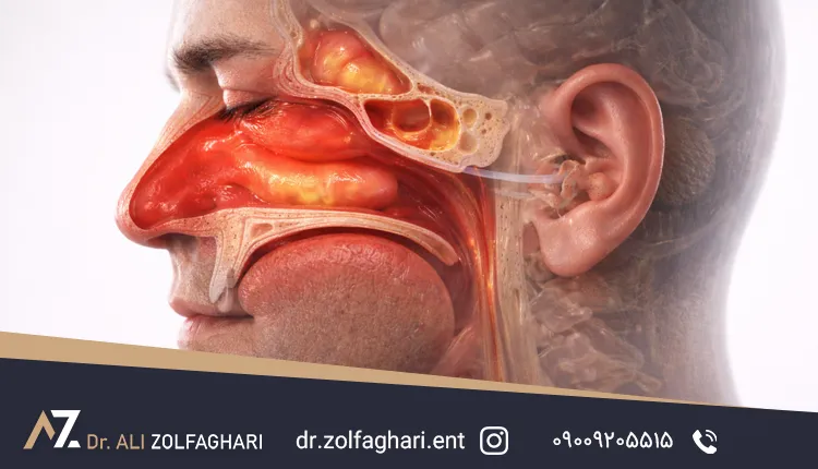 کاهش شنوایی و وزوز مزمن گوش