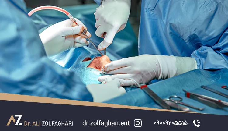 عمل انحراف بینی + مراحل، مراقبت ها، هزینه
