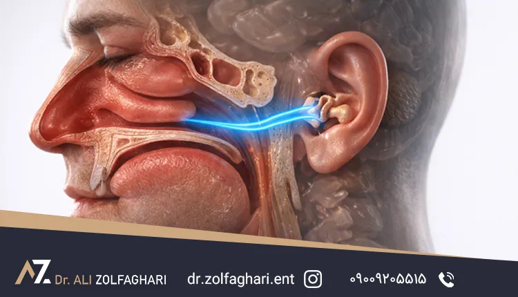 چگونه انحراف بینی می‌تواند باعث اختلالات گوش شود